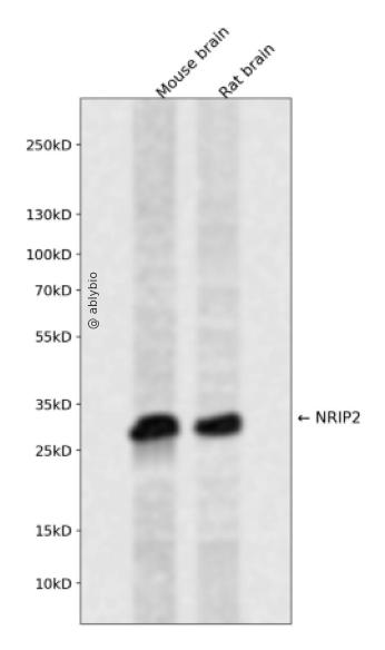 NRIP2 Rabbit pAb