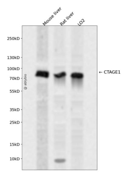 CTAGE1 Rabbit pAb
