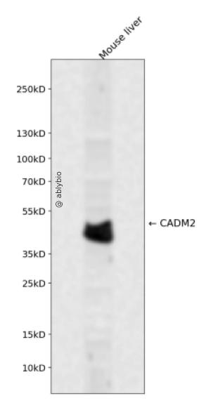 CADM2 Rabbit pAb
