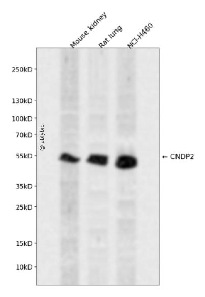 CNDP2 Rabbit pAb
