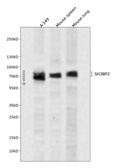 SH3BP2 Rabbit pAb