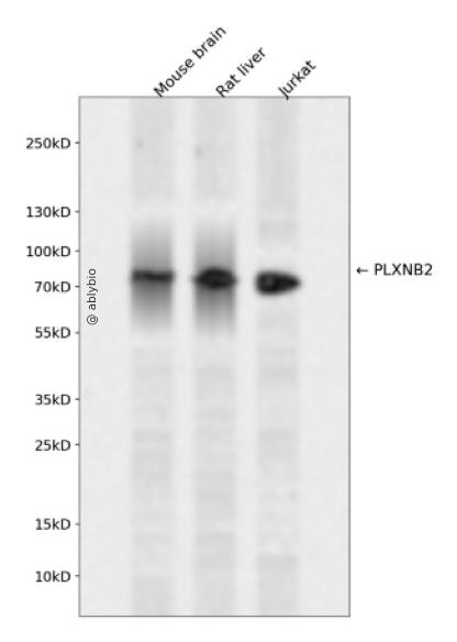 PLXNB2 Rabbit pAb