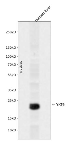 YKT6 Rabbit pAb