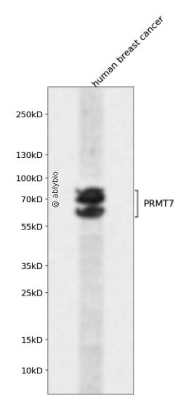 PRMT7 Rabbit pAb