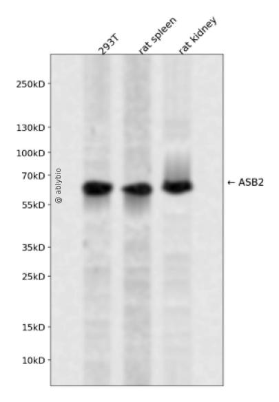 ASB2 Rabbit pAb