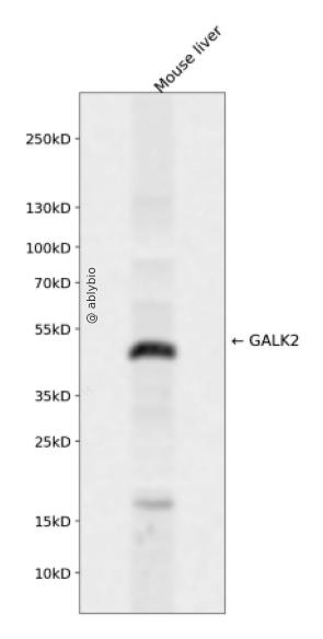 GALK2 Rabbit pAb