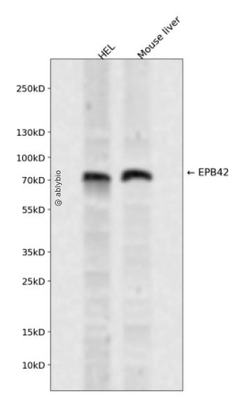 EPB42 Rabbit pAb