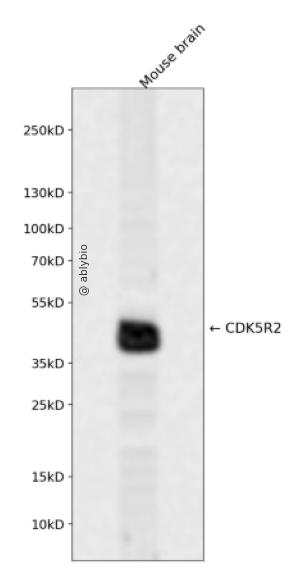 CDK5R2 Rabbit pAb