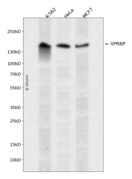 VPRBP Rabbit pAb
