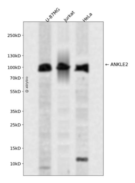 ANKLE2 Rabbit pAb