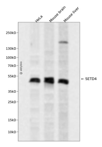SETD4 Rabbit pAb