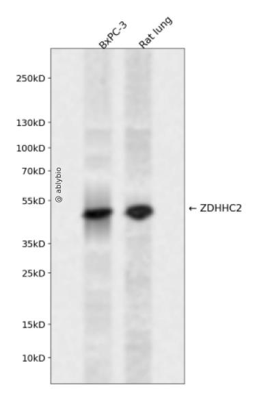 ZDHHC2 Rabbit pAb