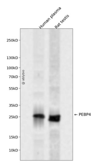 PEBP4 Rabbit pAb