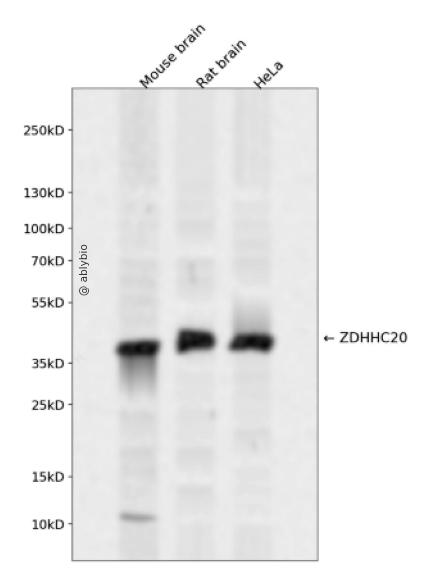 ZDHHC20 Rabbit pAb