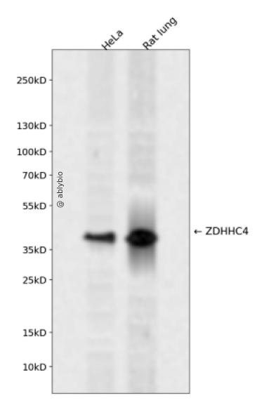 ZDHHC4 Rabbit pAb