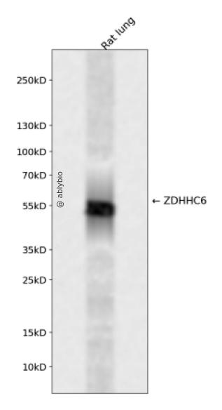 ZDHHC6 Rabbit pAb