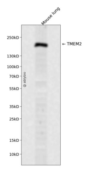 TMEM2 Rabbit pAb