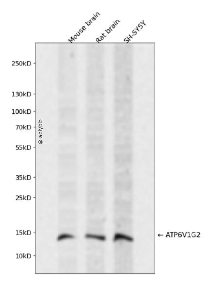 ATP6V1G2 Rabbit pAb