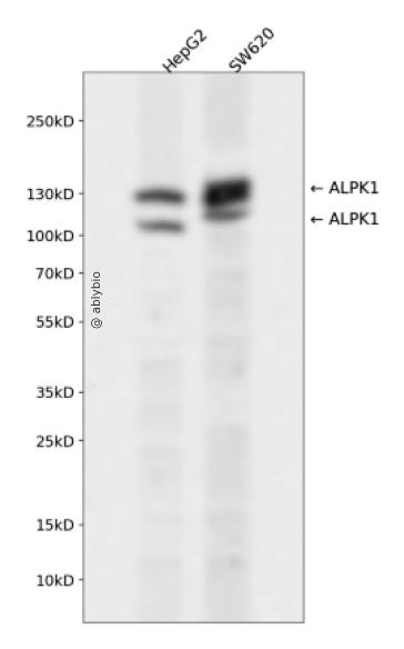 ALPK1 Rabbit pAb