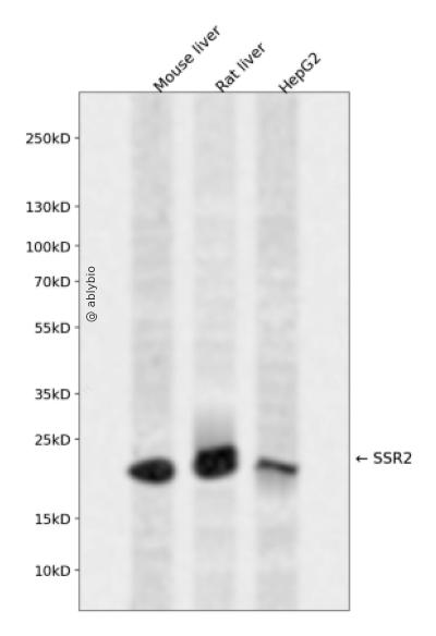 SSR2 Rabbit pAb