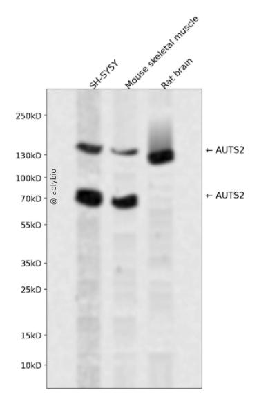 AUTS2 Rabbit pAb