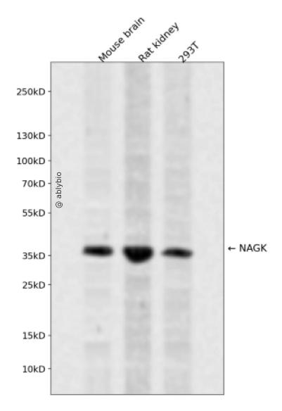 NAGK Rabbit pAb