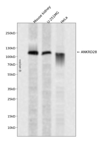 ANKRD28 Rabbit pAb