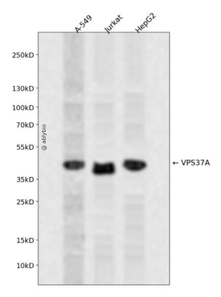 VPS37A Rabbit pAb