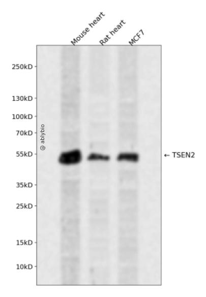 TSEN2 Rabbit pAb
