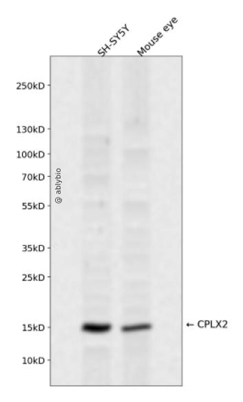 CPLX2 Rabbit pAb