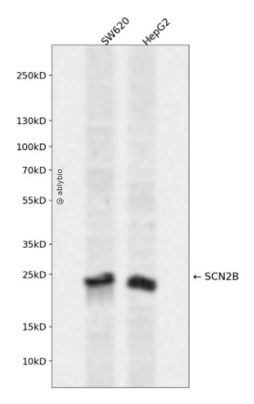 SCN2B Rabbit pAb