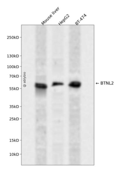 BTNL2 Rabbit pAb