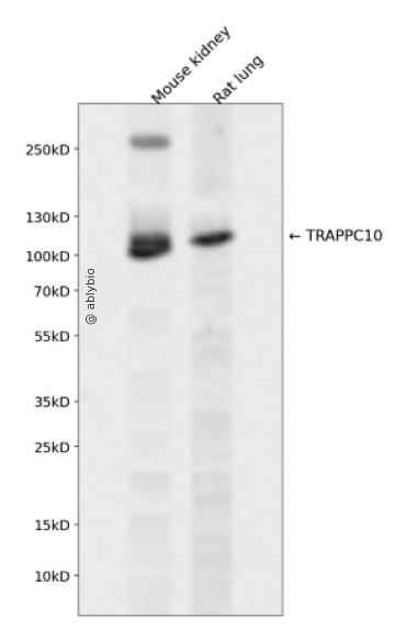 TRAPPC10 Rabbit pAb