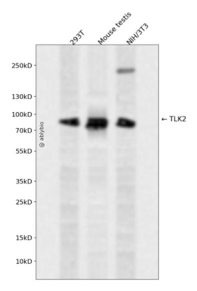 TLK2 Rabbit pAb