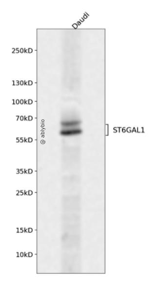 ST6GAL1 Rabbit pAb