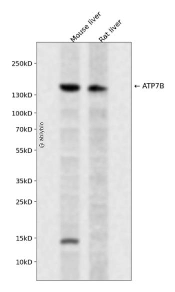 ATP7B Rabbit pAb