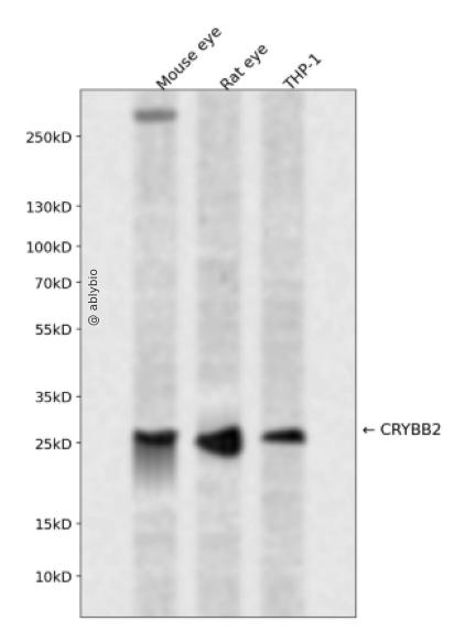 CRYBB2 Rabbit pAb