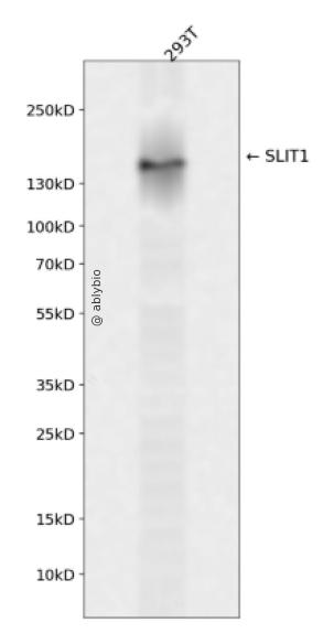 SLIT1 Rabbit pAb