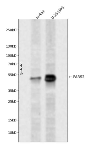 PARS2 Rabbit pAb