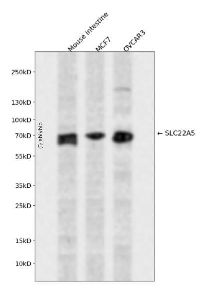 SLC22A5 Rabbit pAb