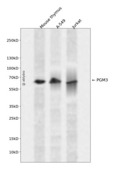 PGM3 Rabbit pAb
