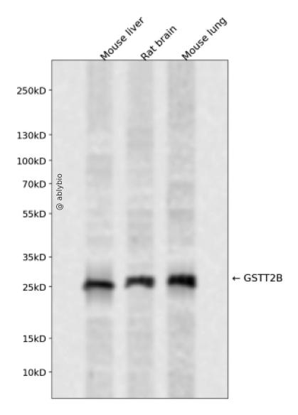 GSTT2B Rabbit pAb