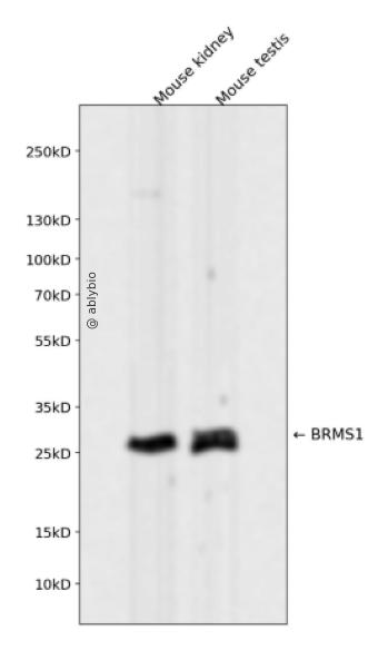 BRMS1 Rabbit mAb
