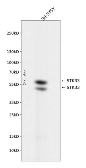 STK33 Rabbit mAb