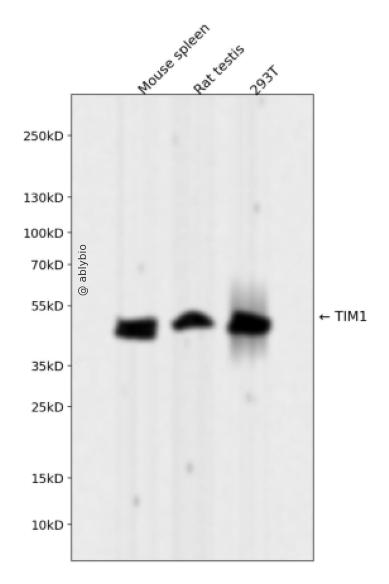 TIM1 Rabbit mAb