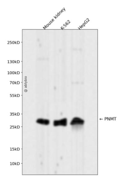 PNMT Rabbit mAb