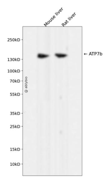 ATP7b Rabbit mAb