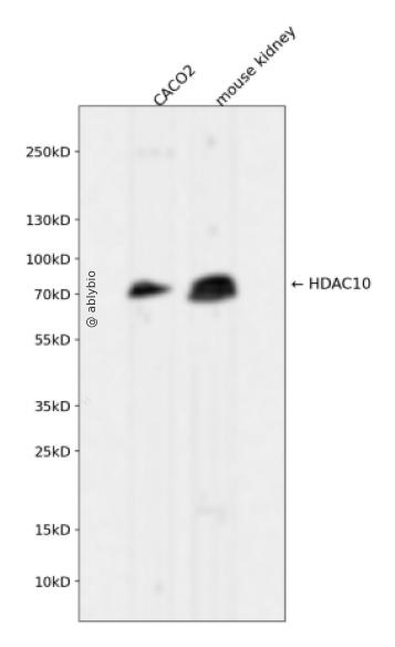 HDAC10 Rabbit mAb