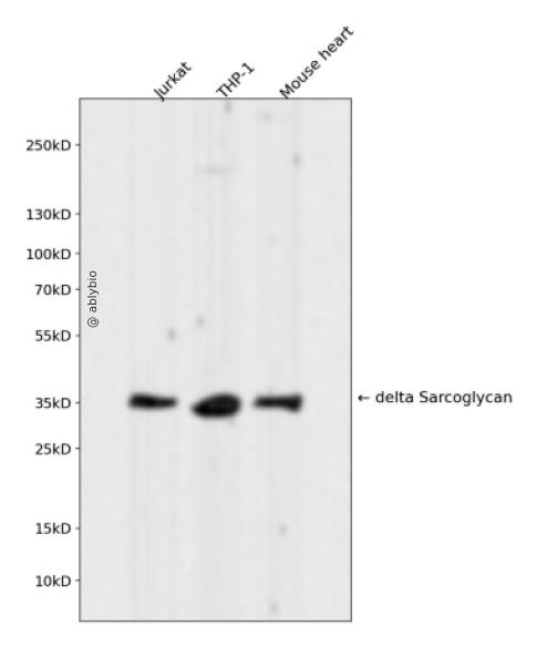 delta Sarcoglycan Rabbit mAb