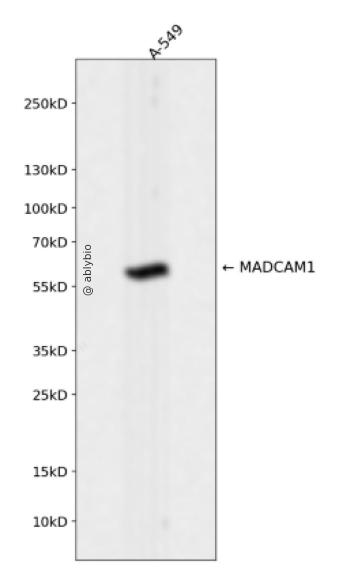 MADCAM1 Rabbit mAb